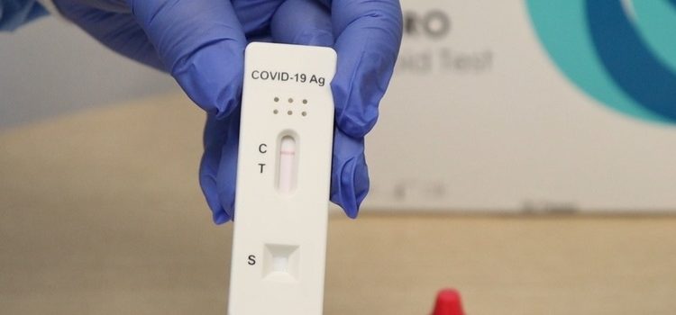 Minas Gerais distribui mais de 1 milhão de testes rápidos de covid-19