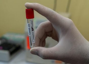 Covid-19: qual o melhor teste para detectar o vírus?
