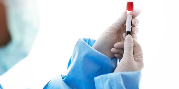 Campanha de doação de sangue marcada para dias 5 e 6 de abril