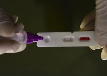 Brasil registra 1.127 mortes em decorrência da Covid-19 em 2024.