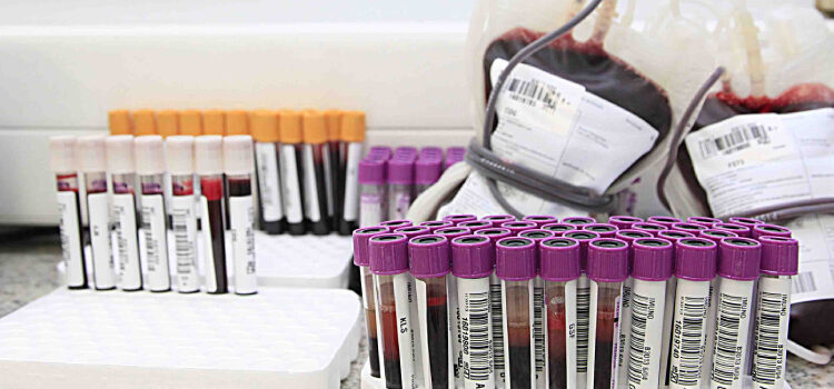 Hemominas convoca doadores de sangue em função das fortes chuvas em Juiz de Fora